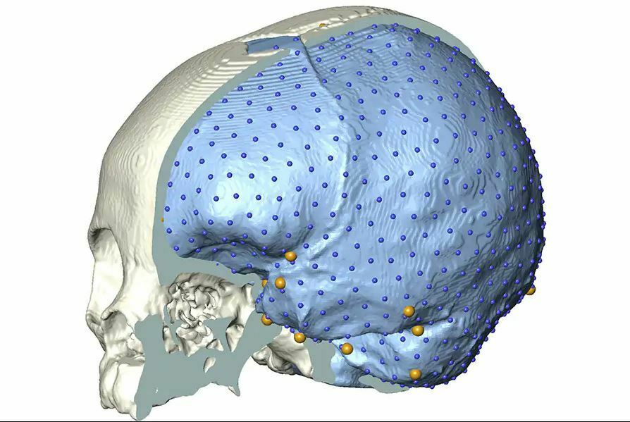 cervello homo sapiens