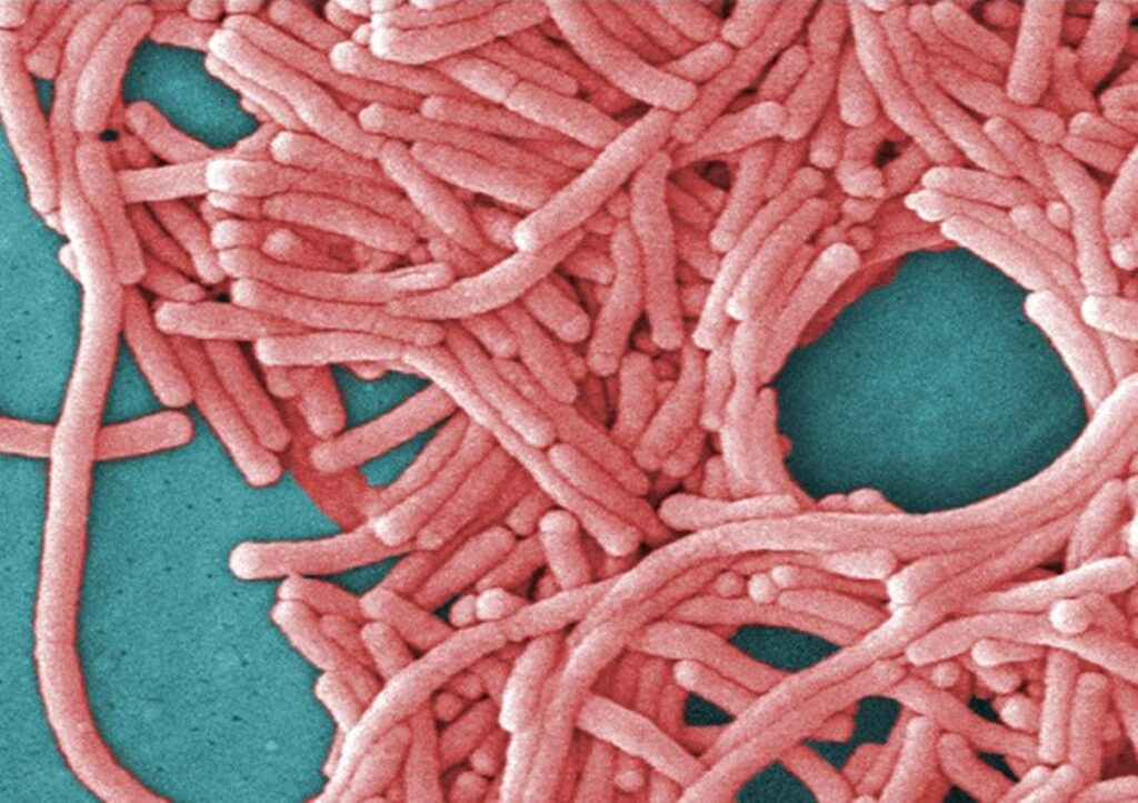 legionella