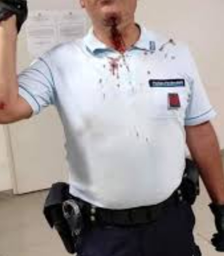 aggressioni polizia