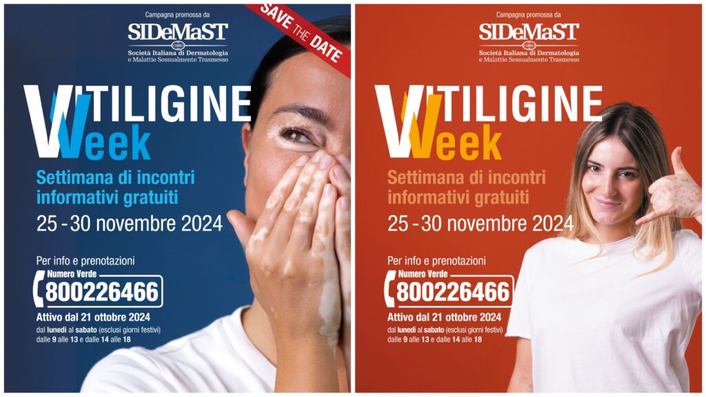 Vitiligine week Calabria